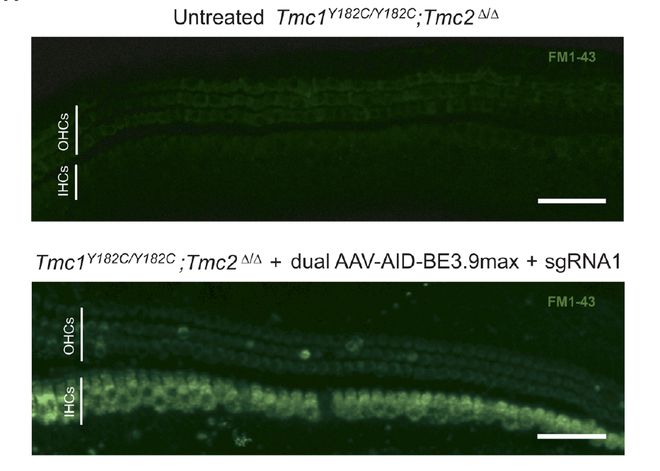 遺傳病治療重大突破：人類首次通過基因編輯攻克隱性遺傳病(圖3)